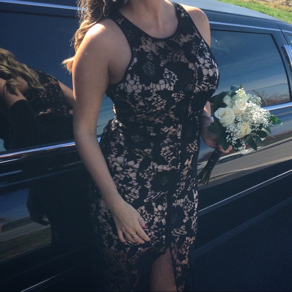 Lace Dress